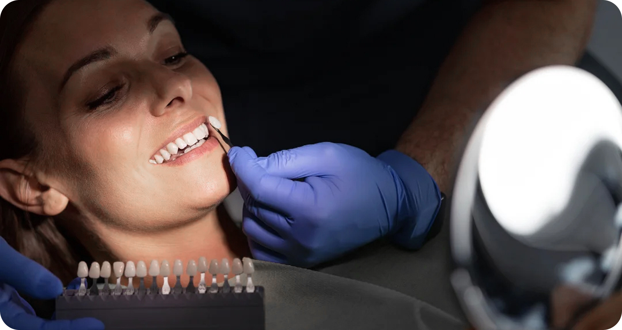 Are you a good candidate for at-home teeth whitening
