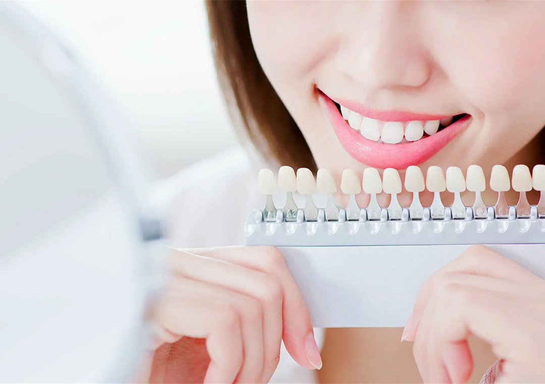 Dr. Adam Geach Dental Practitioner Specialized in Prosthodontics At-Home Teeth Whitening