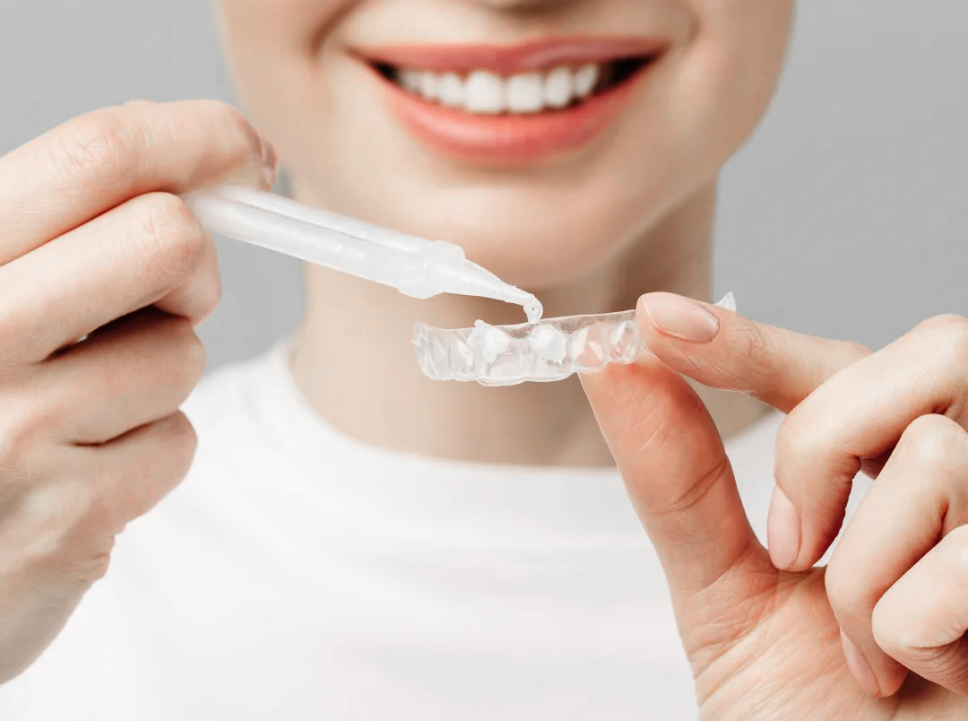 More about at-home teeth whitening at Geach Dental