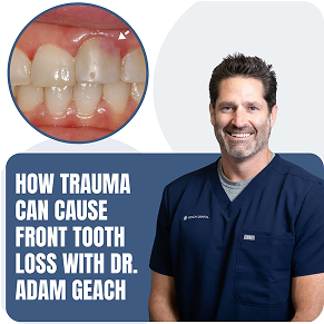 Replacement of Front Teeth Lost Due To Trauma