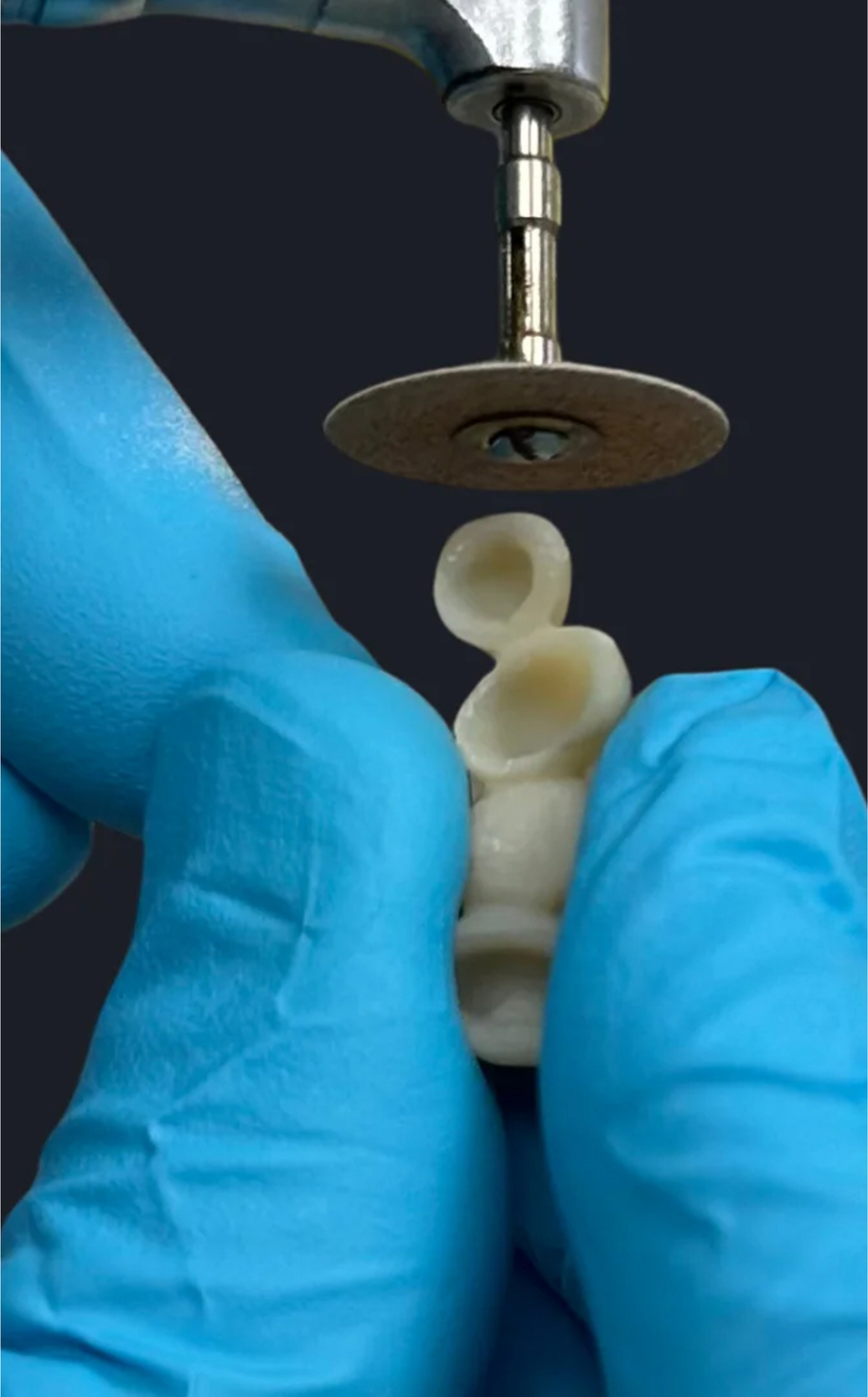 Discover the versatility of dental bridges - Geach Dental