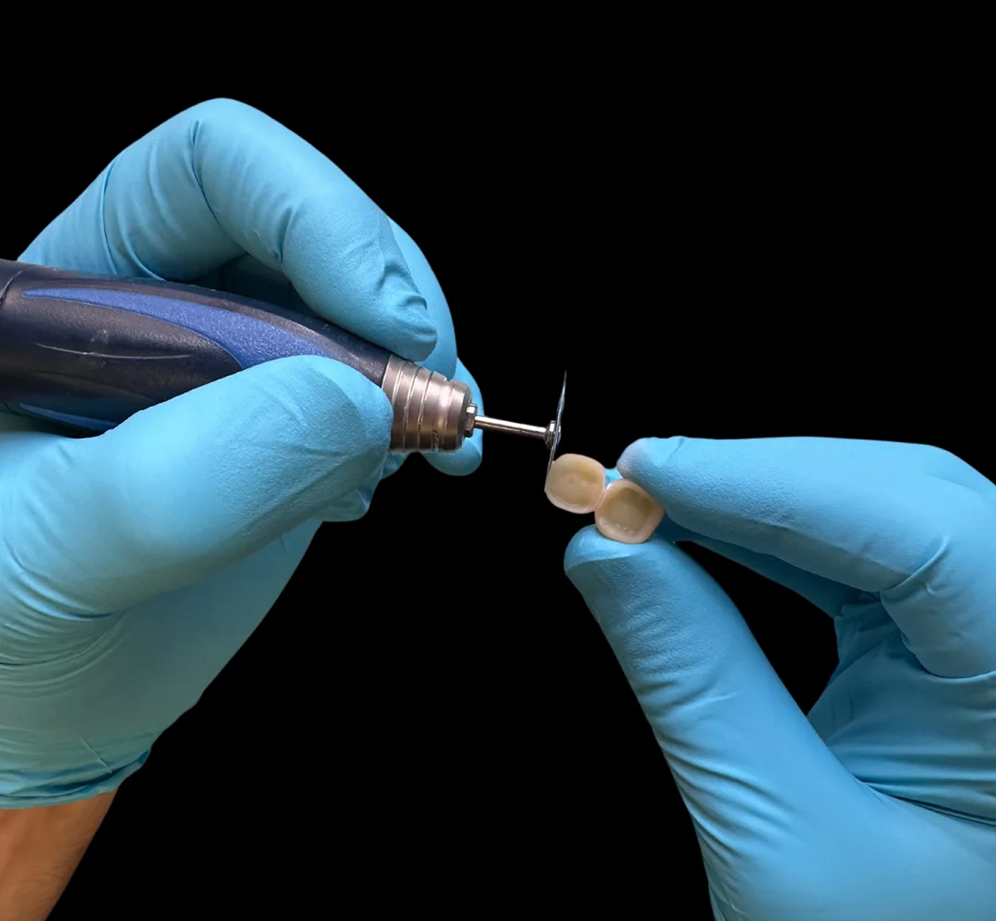 More about dental crowns at Geach Dental