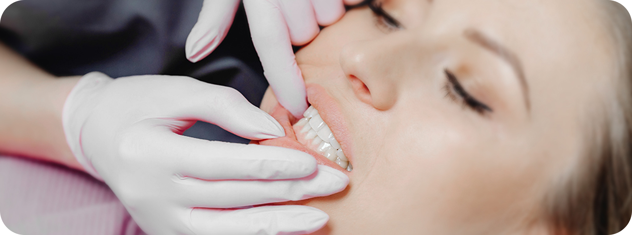 Are you a good candidate for direct bonding