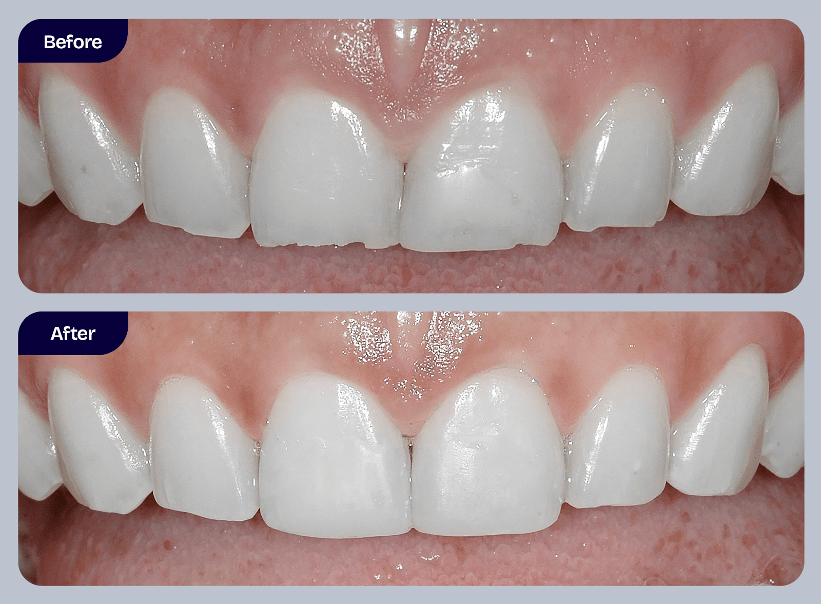 Dr. Adam Geach Dental Practitioner Specialized in Prosthodontics Direct Bonding