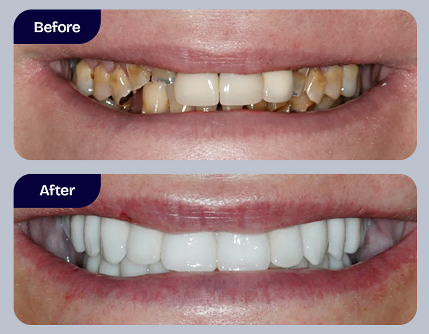 Dr. Adam Geach Dental Practitioner Specialized in Prosthodontics Full-Mouth Reconstruction