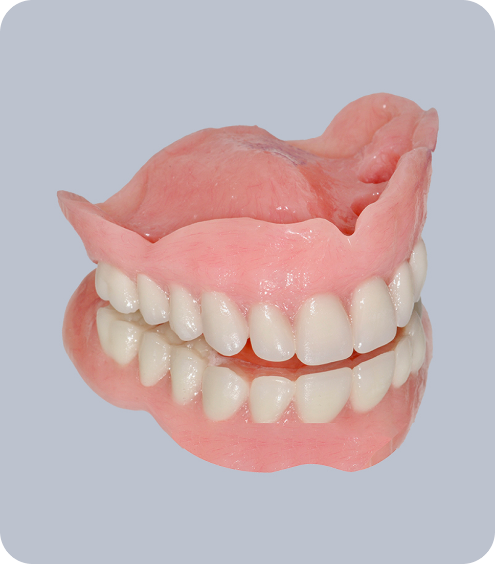 Full-Mouth Reconstruction - Dentures