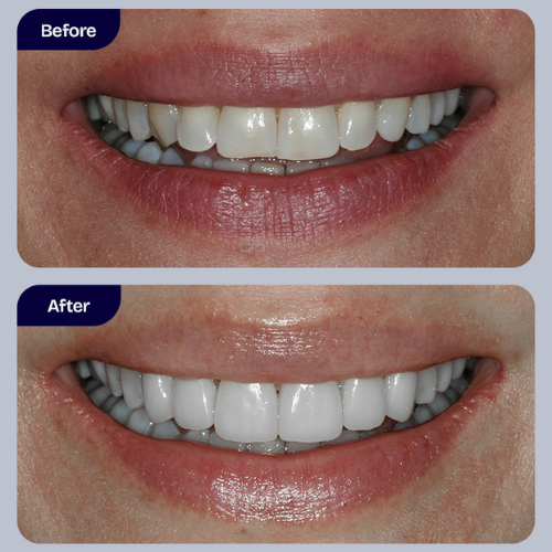 Cosmetic Dentistry