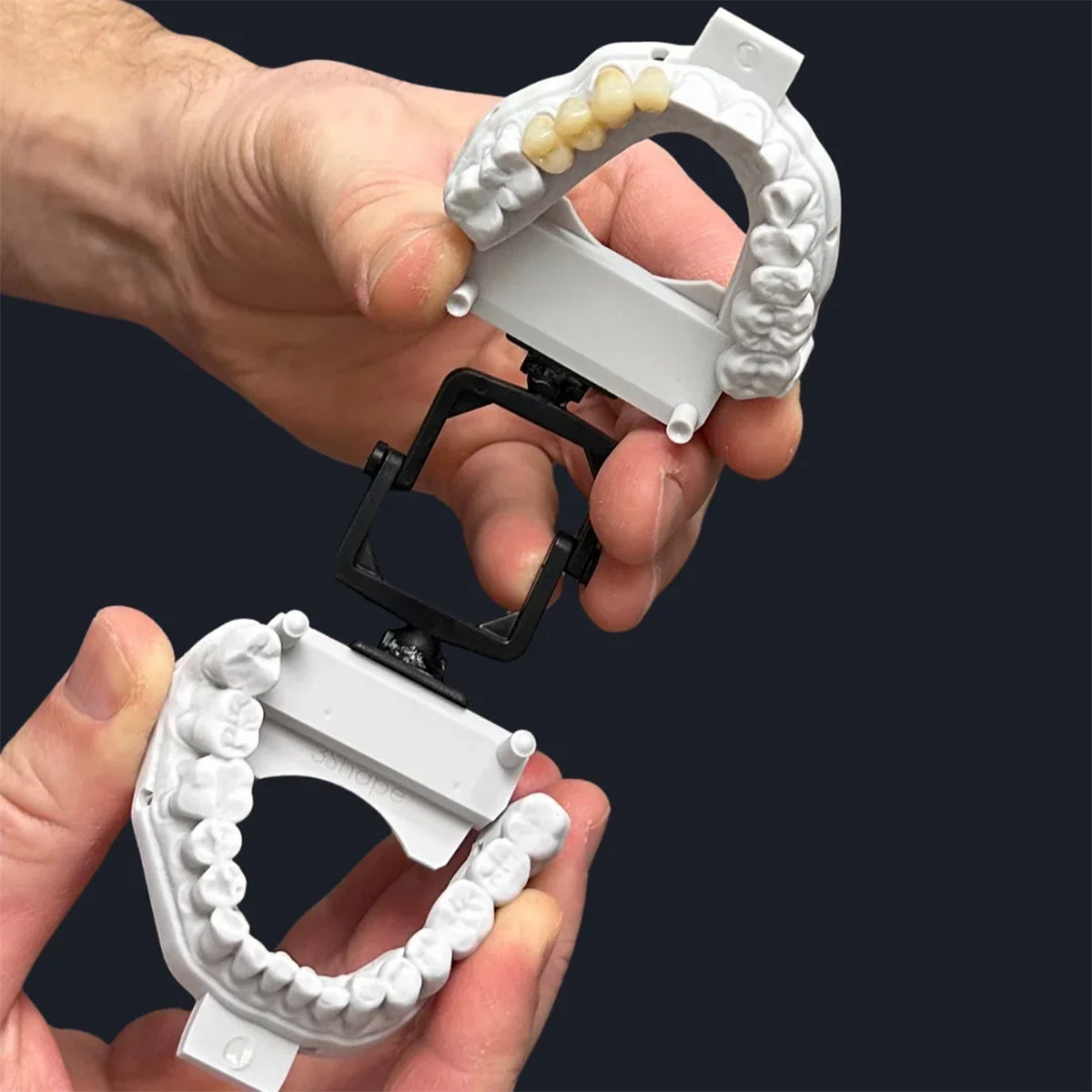 Dental Bridges