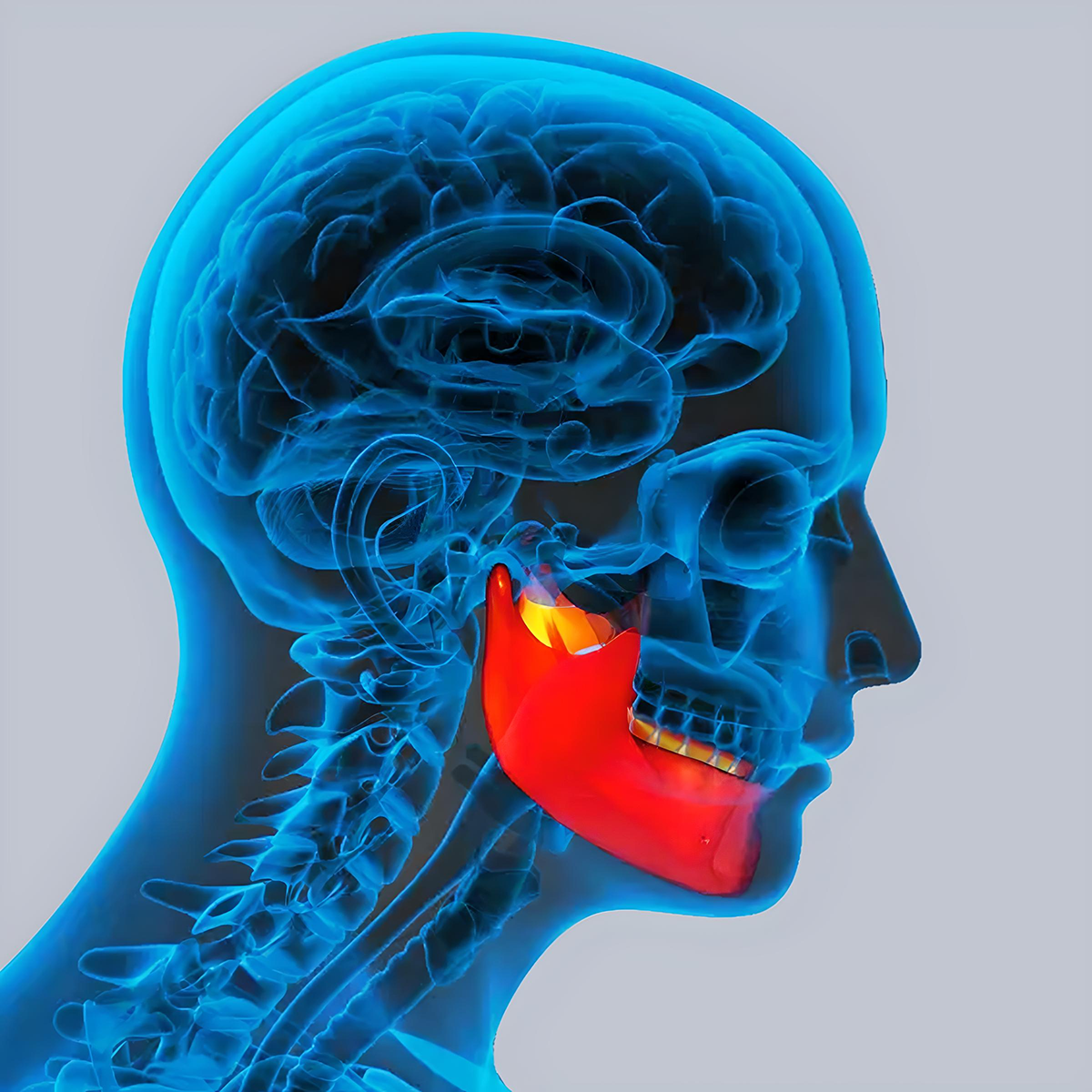 TMJ Therapy