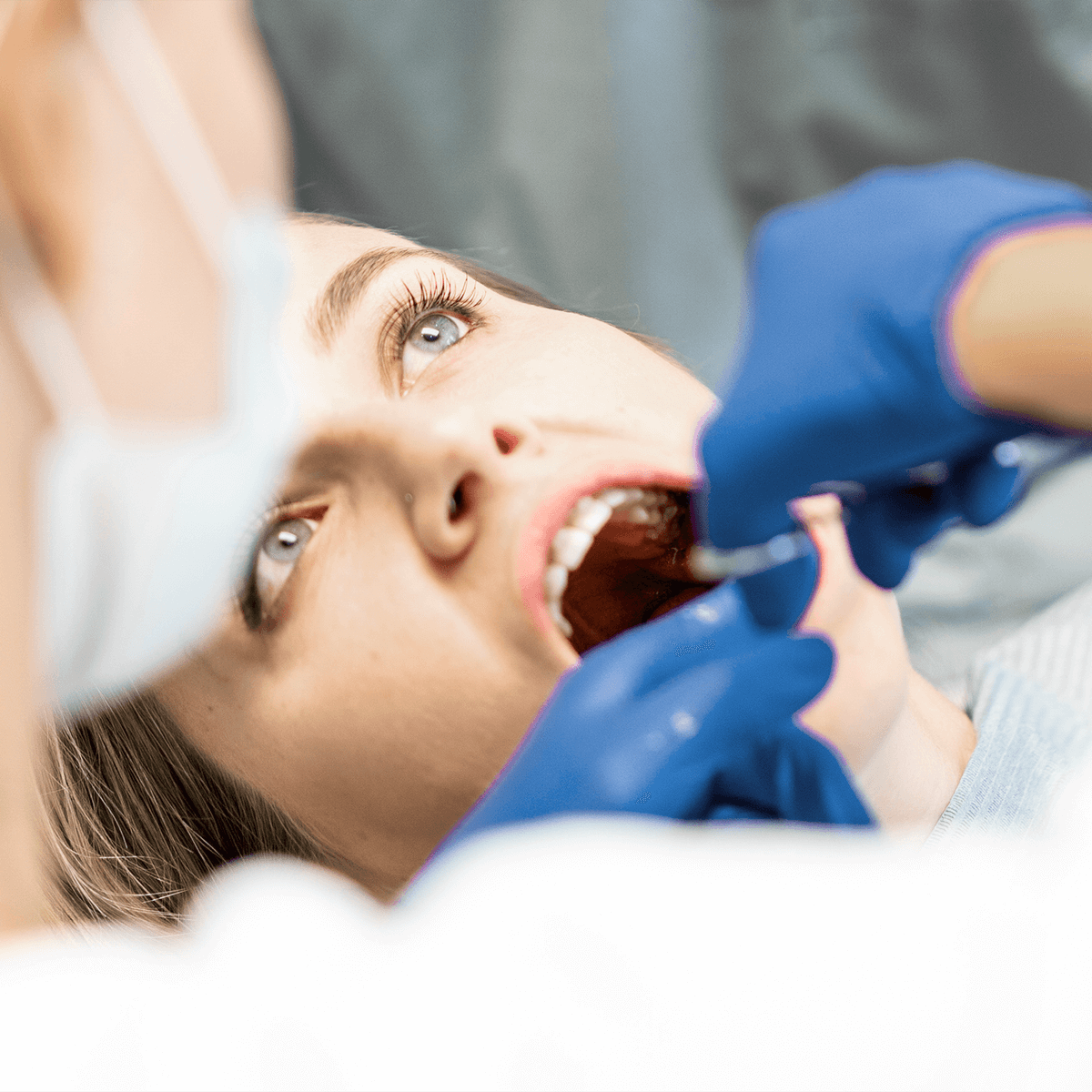Tooth Extractions