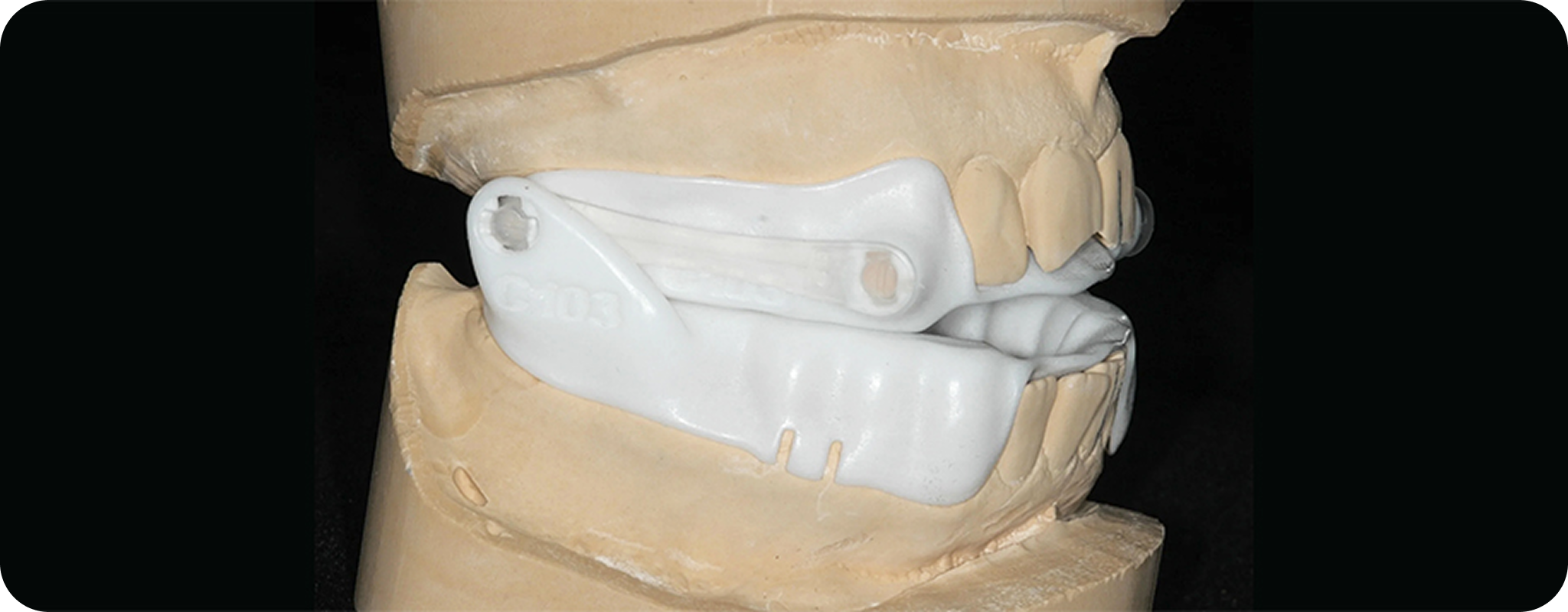 Types of Sleep Apnea Treatment - Dr. Adam Geach Dental Practitioner
