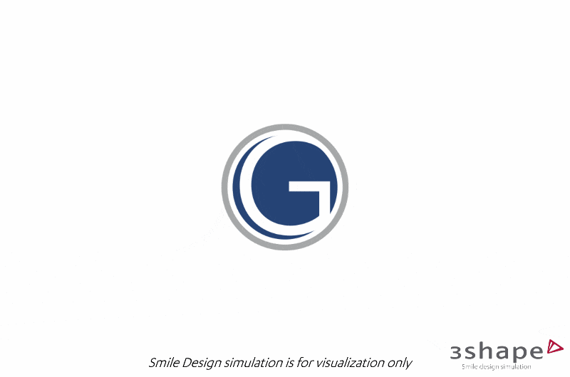 Smile makeover digital imaging preview