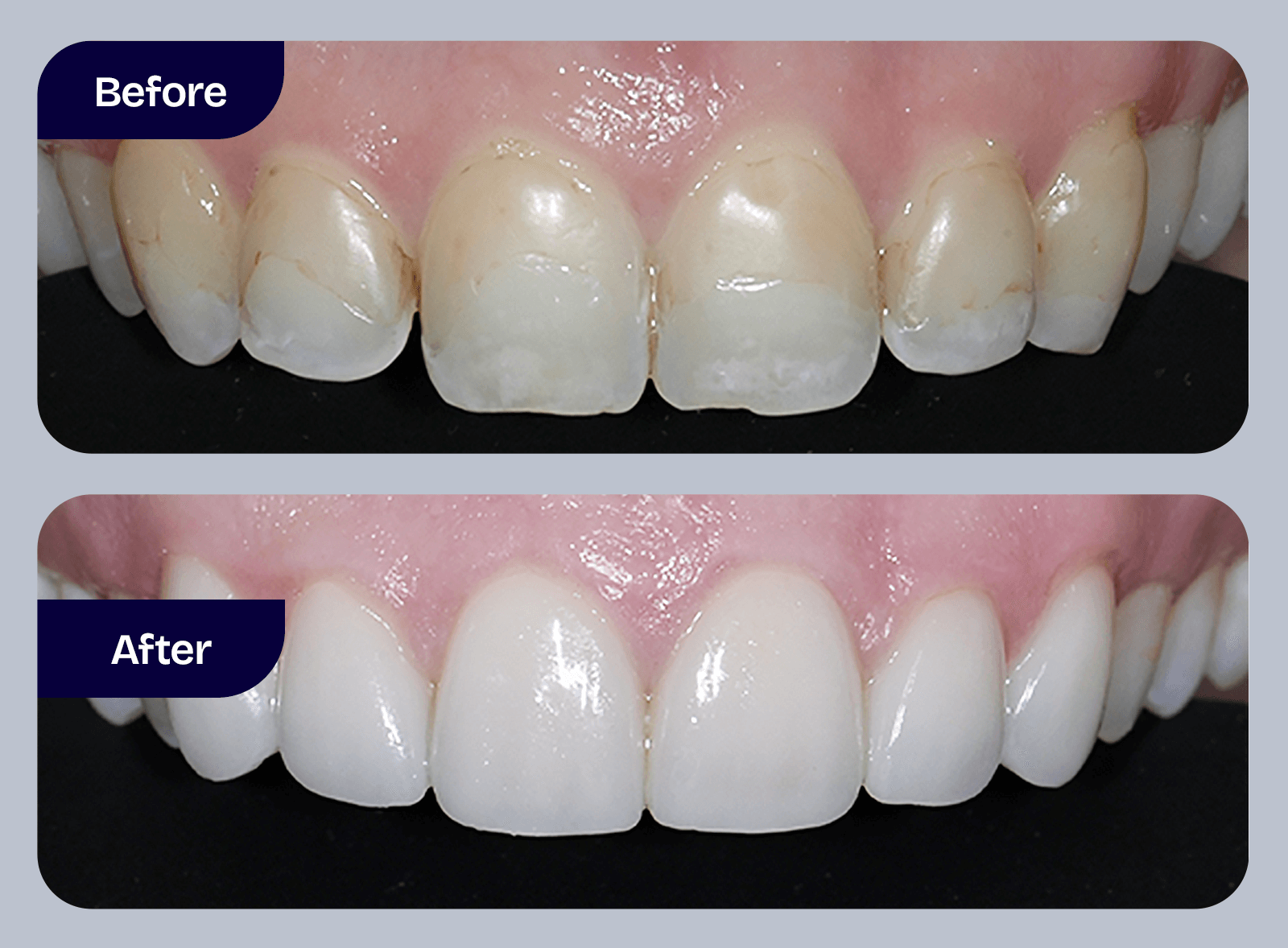 Dr. Adam Geach Dental Practitioner Specialized in Prosthodontics Smile Makeover