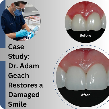 Case Study: A Prosthodontist Restores A Damaged Smile