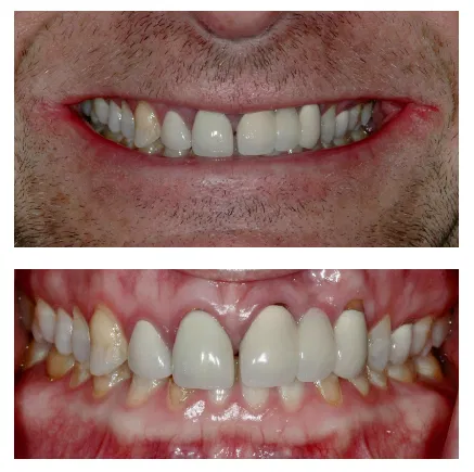 How A Smile Makeover Can Transform Your Aesthetics And Boost Your Confidence