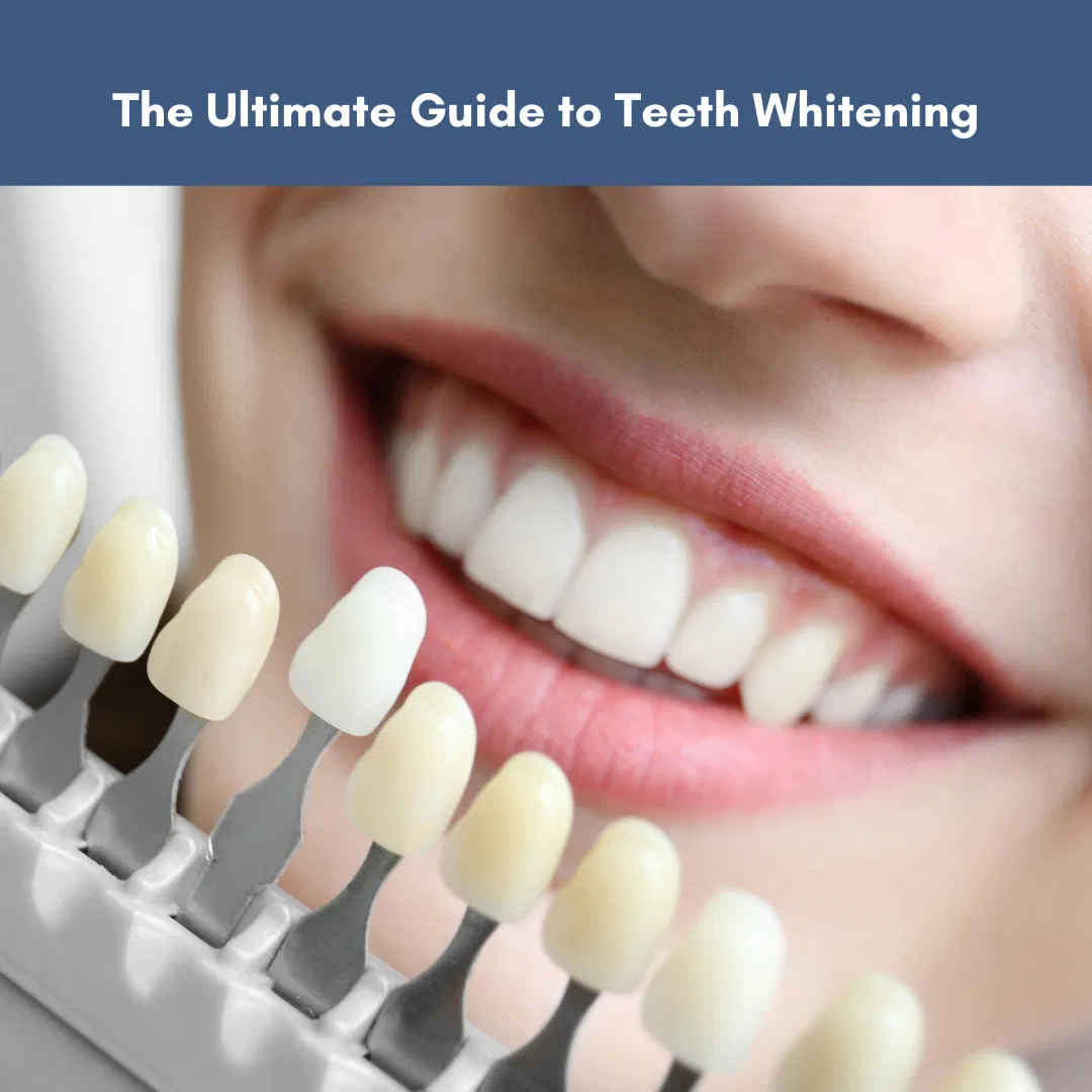 The Ultimate Guide to Teeth Whitening