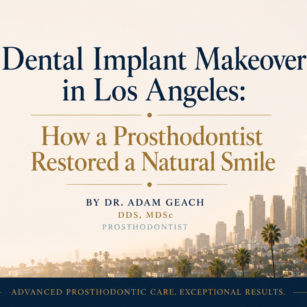 Dental Implant Makeover in Los Angeles: How a Prosthodontist Restored a Natural Smile
