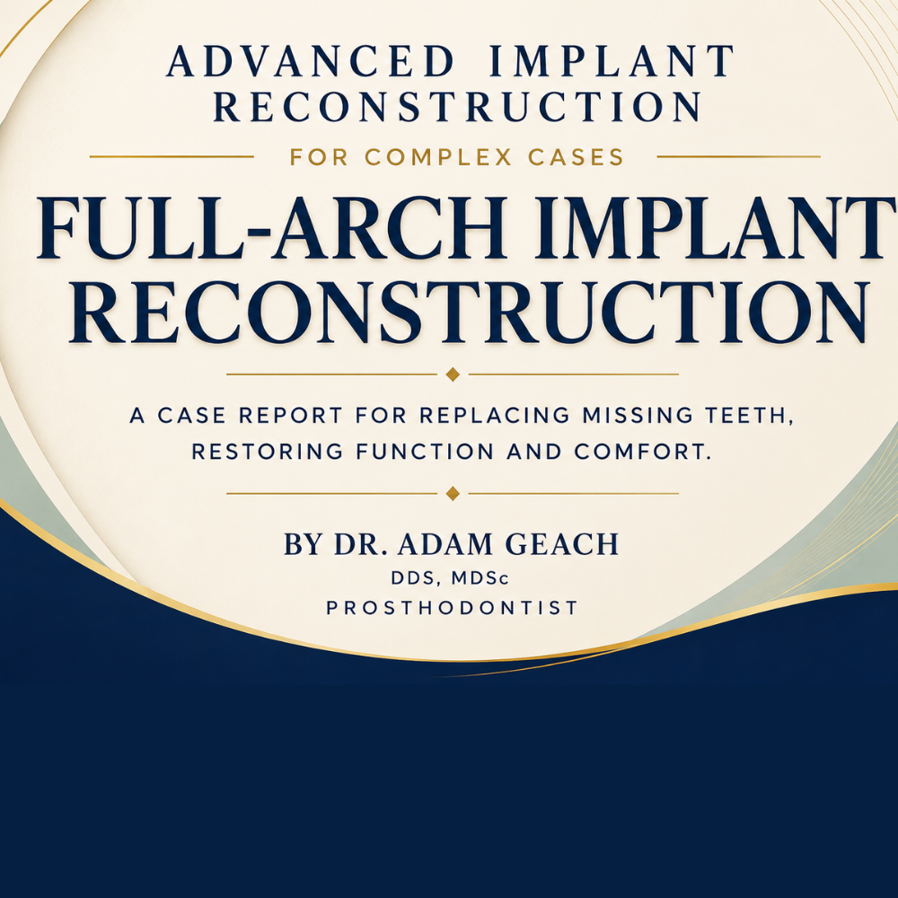 Full-Arch Dental Implant Rehabilitation Case Report